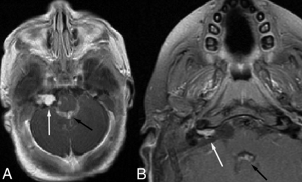 Fig 6.