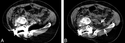 Fig 3.