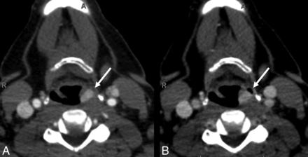 Fig 3.
