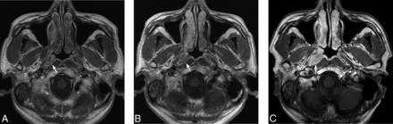 Fig 2.