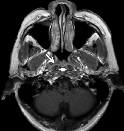Fig 3.