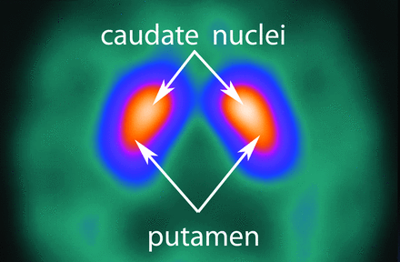 Fig 2.