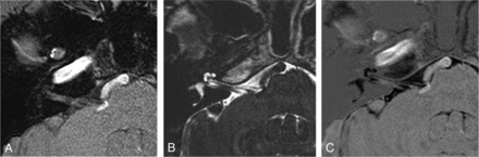 Fig 1.