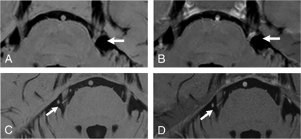 Fig 3.