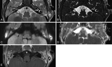 Fig 3.