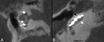 Fig 3.