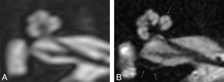 Fig 2.