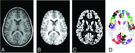 Fig 1.