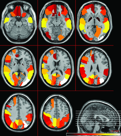 Fig 4.