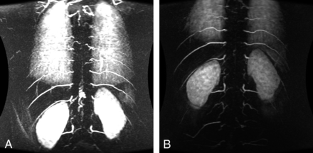 Fig 2.