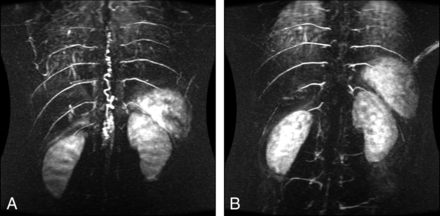 Fig 3.
