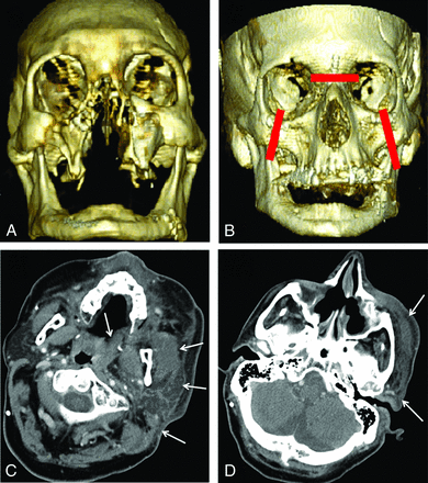 Fig 1.