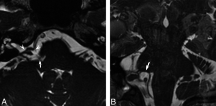 Fig 3.