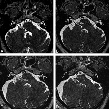Fig 4.