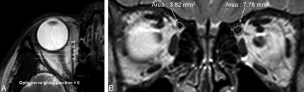 Fig 1.