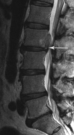 Fig 1.