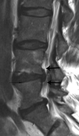 Fig 2.
