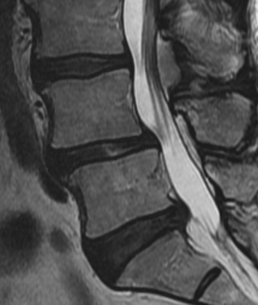 Fig 3.