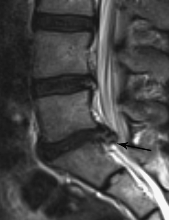 Fig 4.