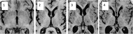 Fig 1.