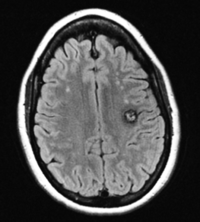 Fig 2.