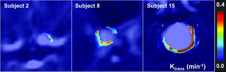 Fig 3.