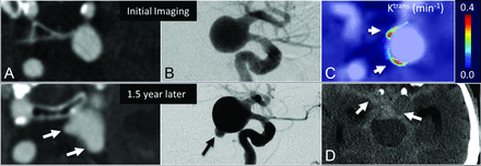 Fig 4.