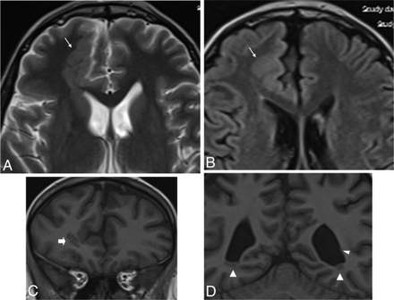 Fig 2.