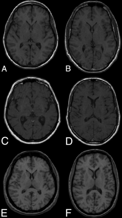 Fig 1.