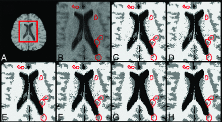 Fig 4.