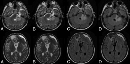 Fig 1.