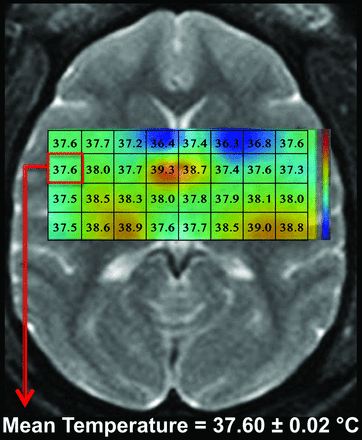 Fig 6.