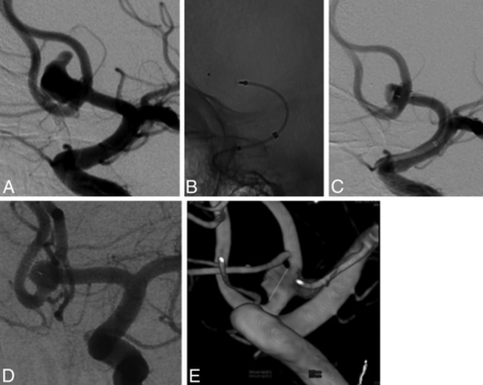 Fig 3.