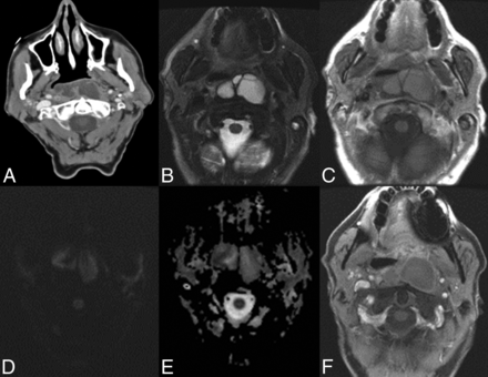 Fig 3.