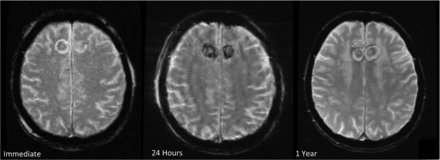 Fig 4.