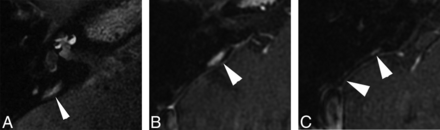 Fig 3.