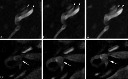 Fig 4.
