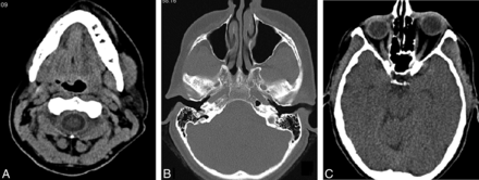 Fig 1.