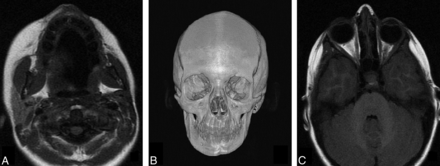 Fig 2.