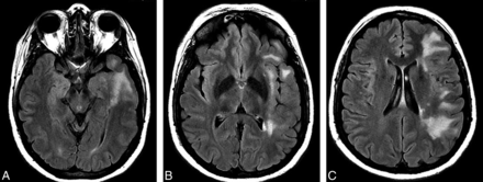 Fig 6.