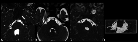 Fig 1.