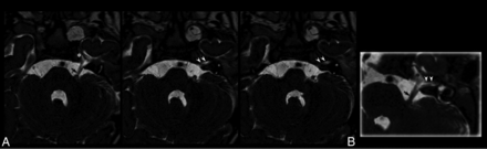 Fig 2.