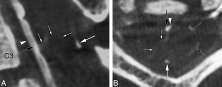 Fig 2.
