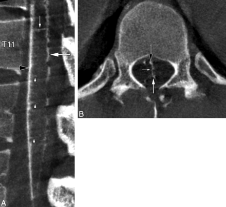 Fig 3.