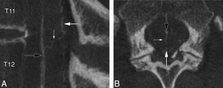 Fig 4.