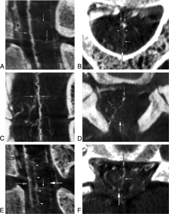 Fig 7.