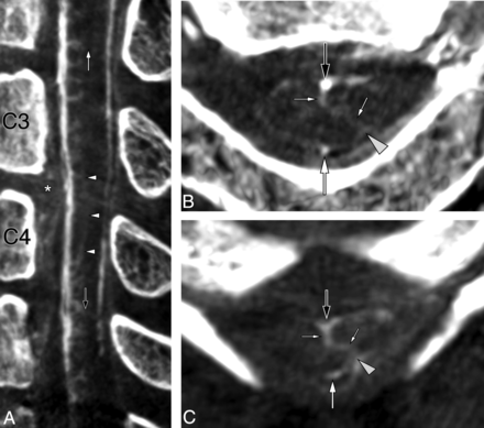 Fig 8.