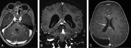 Fig 2.