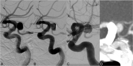 Fig 3.