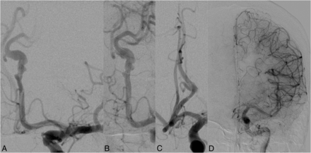Fig 4.